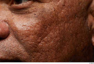 HD Face Skin Everson Baker cheek face skin pores skin…